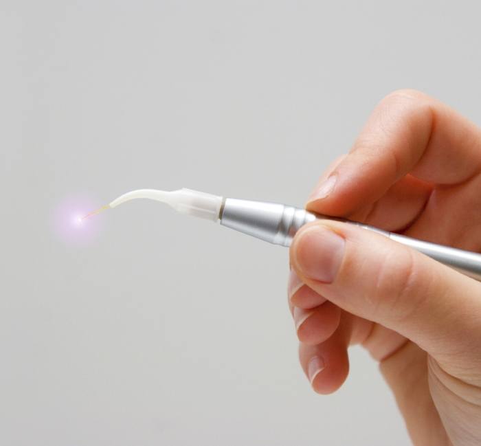 Hand holding soft tissue laser dentistry hand tool