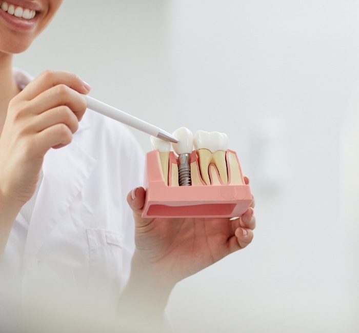 Dentist using smile model to explain the four step dental implant process