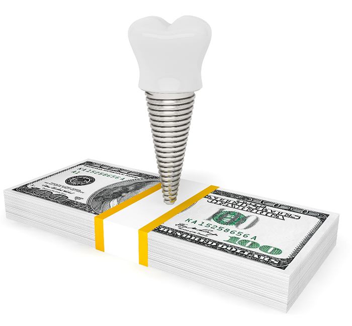 Dental implant on a pile of money