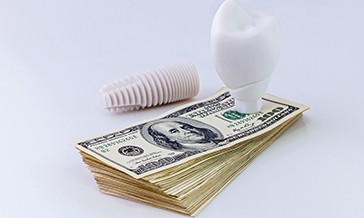 Dental implant on a pile of cash