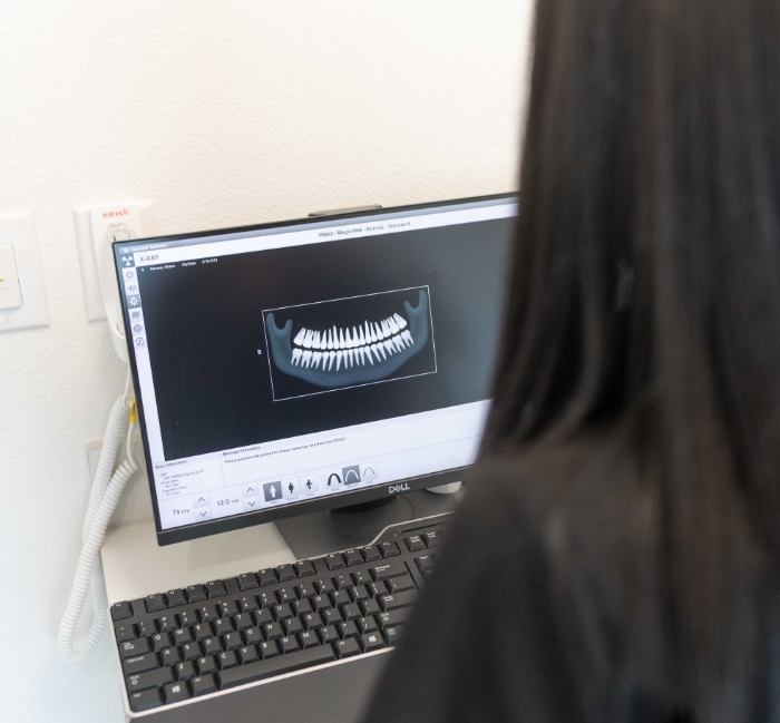 Dental team member looking at digital x rays