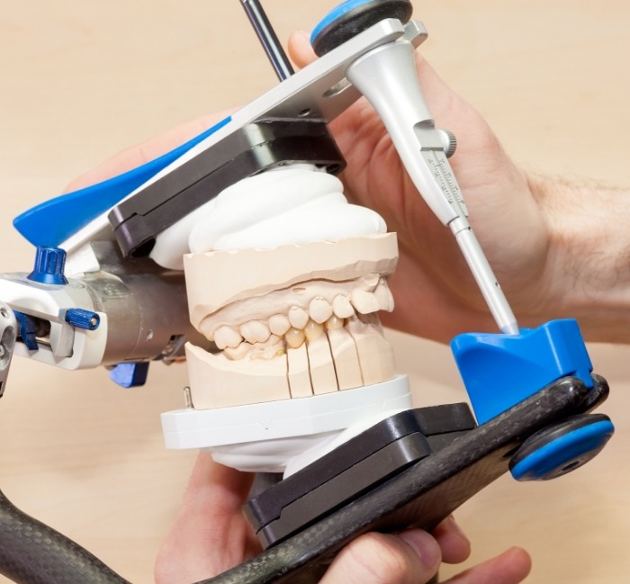 Model smile using to explain equilibration and occlusal adjustments