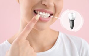 Woman smiling and pointing at her dental implant