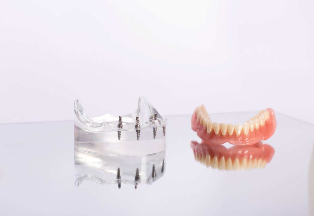 Lower arch of dentures next to transparent model jaw with 4 dental implants